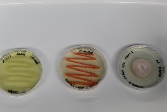 bacteria smears and a mold growth